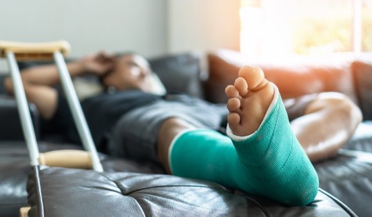 Bone fracture foot and leg on male patient with splint cast and crutches during surgery rehabilitation and orthopaedic recovery staying at home